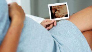 3D-УЗИ при беременности: мифы и реальность
